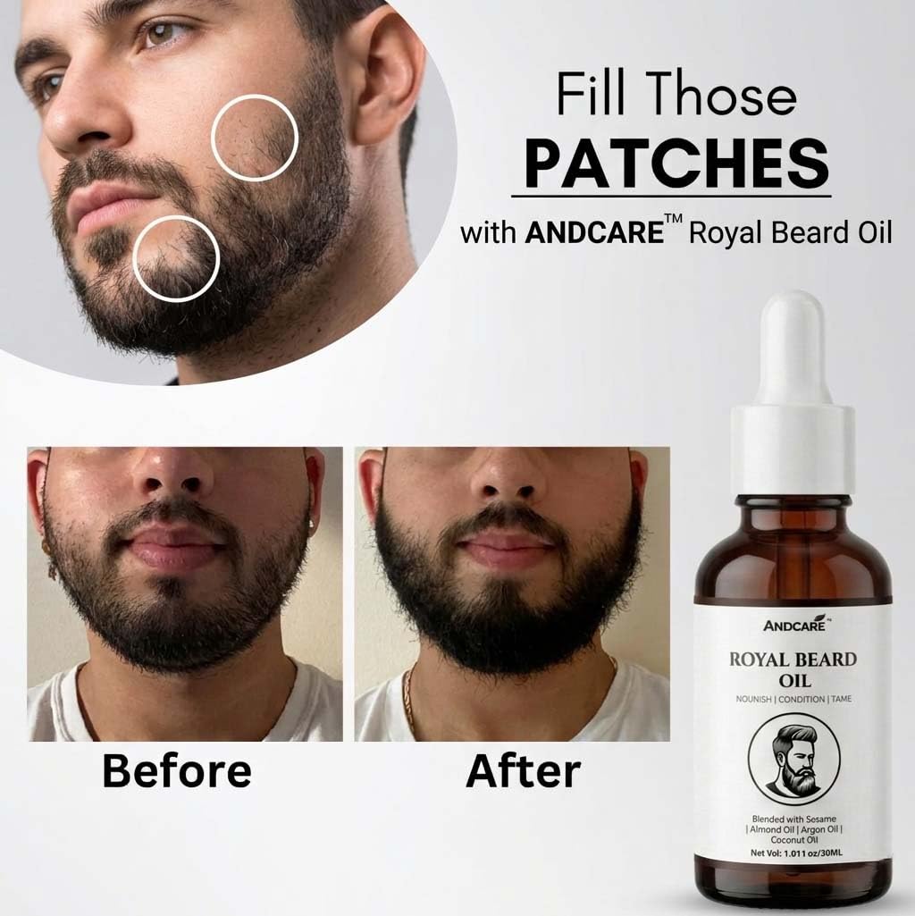 Beard Oil for Men | Beard Growth for Patchy Beard, No Itching & Dandruff | Thicker & Longer Beard | Non Sticky and Non Greasy | All Beard Types | 30ml